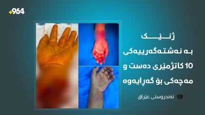 لە بەغدا باسکى بڕدراوی ژنێک دوای 10 کاتژمێر نەشتەرگەری چاندرایەوە