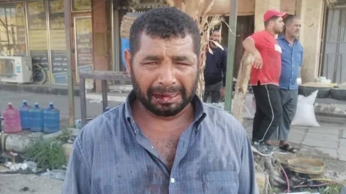 Sanitation worker assaulted in Diwaniyah for confronting illegal trash dumping