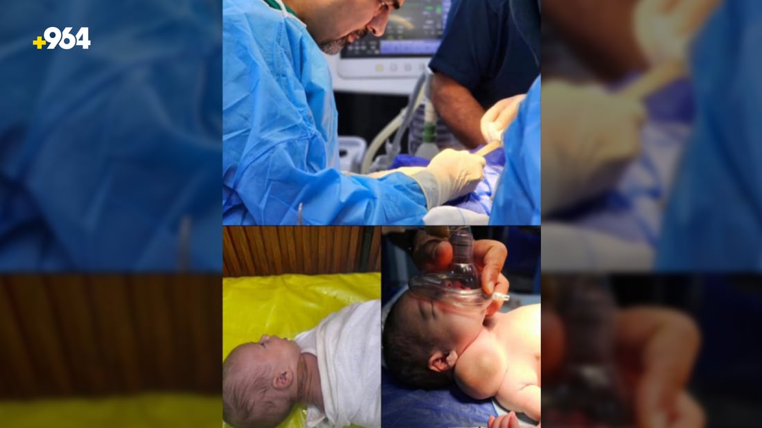 نەشتەرگەریەکى سەرکەوتوو بۆ کۆرپەیەکى تەمەن 20 کاتژمێرى ئەنجامدرا