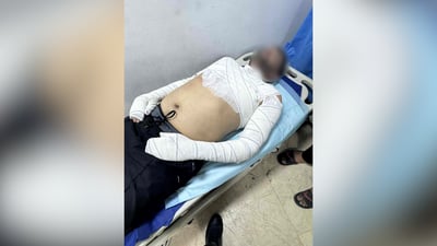 إحباط محاولة انتحار 3 أشقاء بالحرق وسط الكوت بعد نزاع على “كشك” للأطعمة