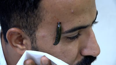 دودة تعالج ضعف الجنس في سوق الشيوخ ويلسعك النحل وسترى النتائج