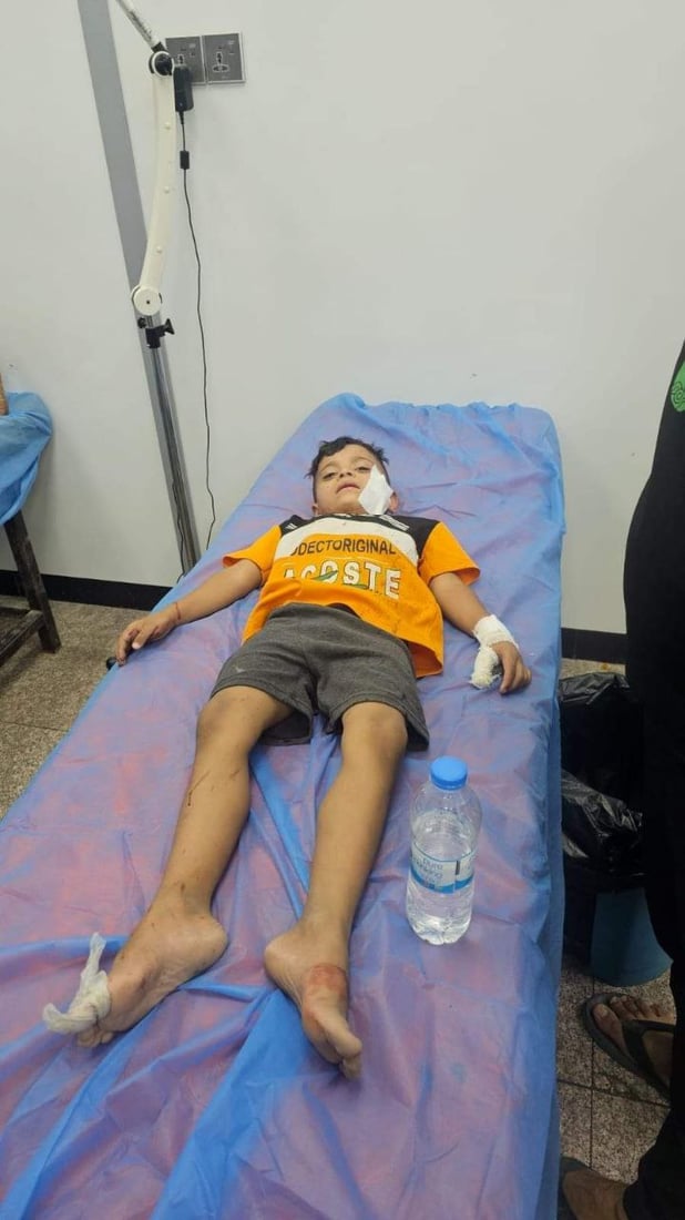 قطيع من الكلاب السائبة يهاجم 8 أطفال في الناصرية ويصيبهم بجروح متفاوتة