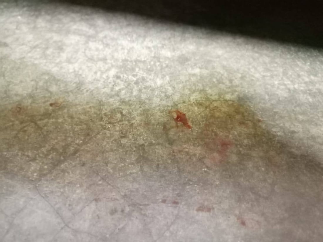 صور مؤلمة من المشاهدة: فتاة تطلق النار على نفسها بعد شجار عنيف بين والديها