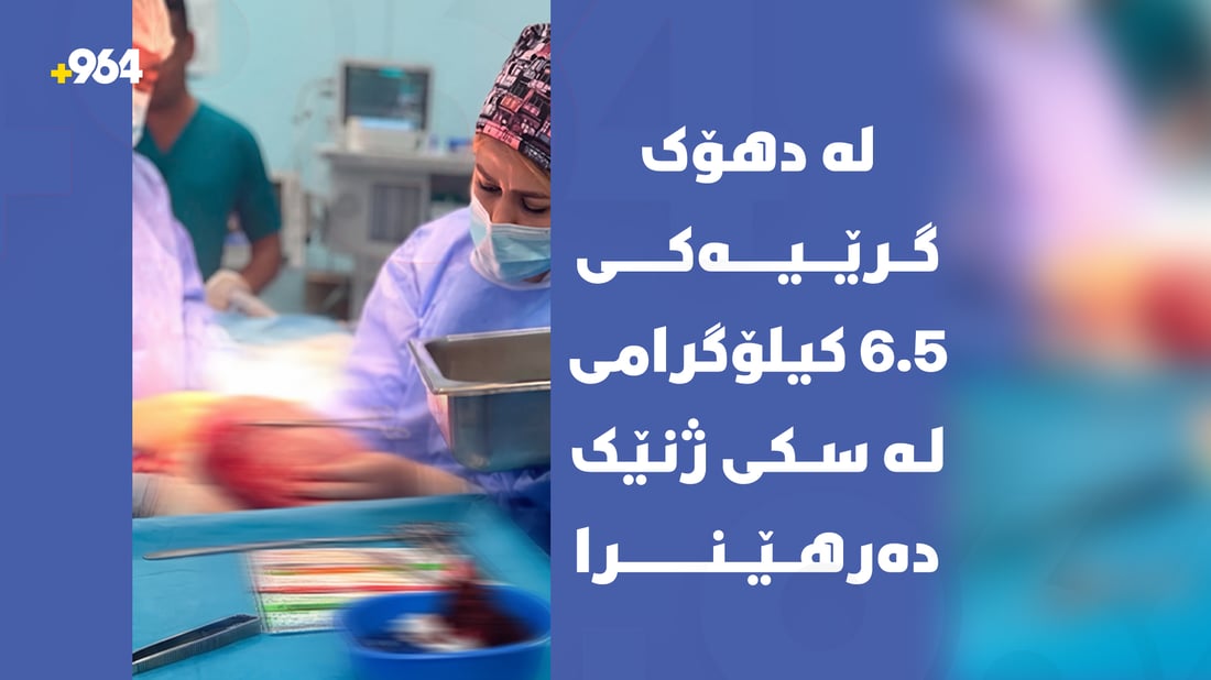 لە دهۆک گرێیەکی 6.5 کیلۆگرامی لە سکی ژنێک دەرهێنرا