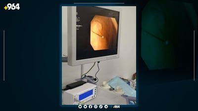 دەرزی لەچک لە گەدەی ژنێک دەرهێنرا