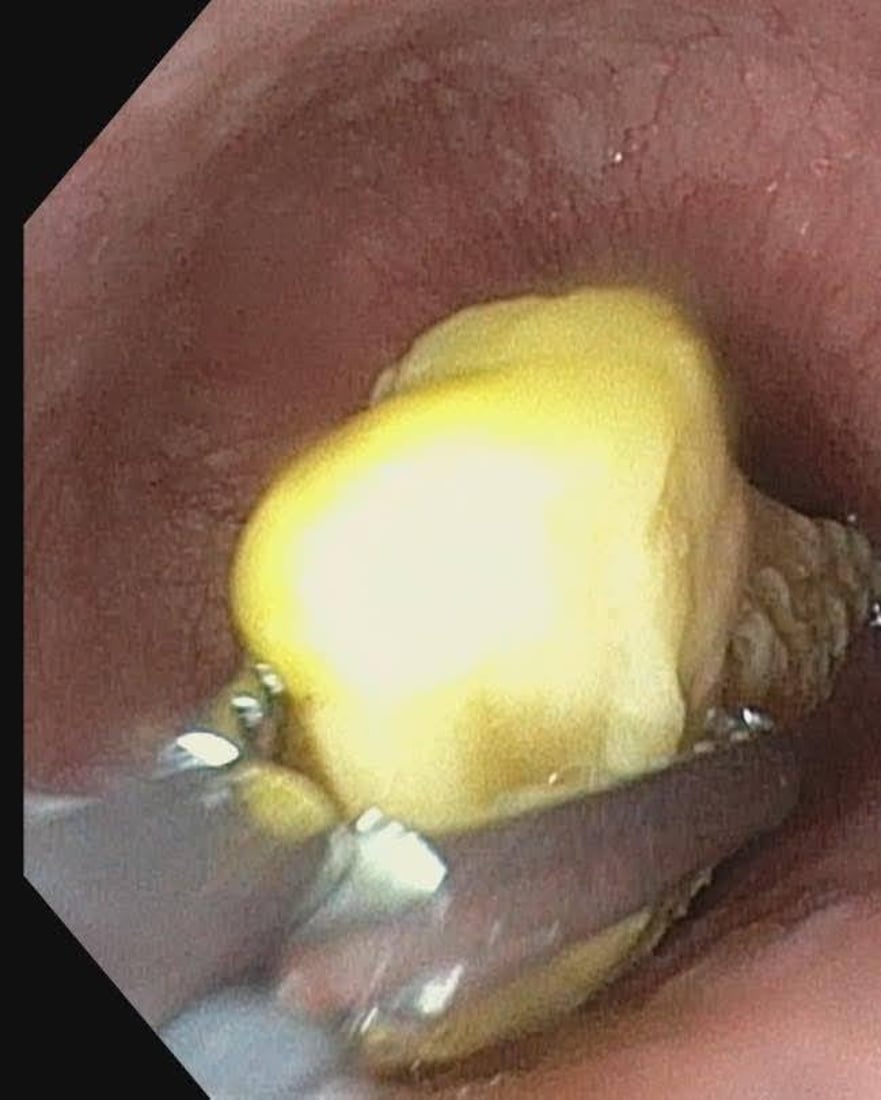 منداڵێکی تەمەن 13 ساڵ لەمردن گەڕایەوە