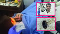 Beetle removed from child’s ear in Erbil