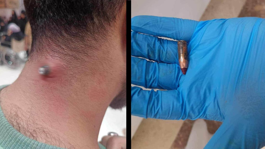 ئەو کاتەی نوێژی مەغریبی دەکرد گوللەیەک بەر ملی کەوت