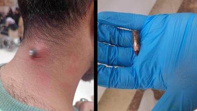 ئەو کاتەی نوێژی مەغریبی دەکرد گوللەیەک بەر ملی کەوت