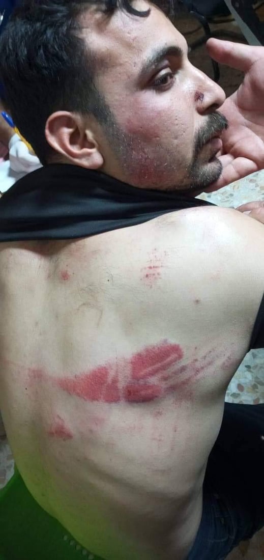 ليلة عصيبة في الكوت: غضب في محيط مكتب سجاد سالم.. وتسجيل إصابات