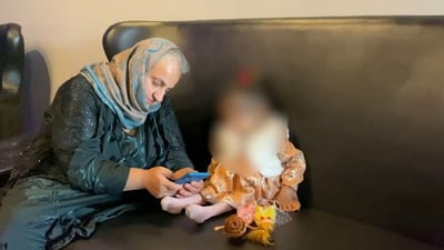 دهوك: طفلة تعاني 12 مرضاً.. وأطباؤها يسعون لإدخالها إلى غينيس