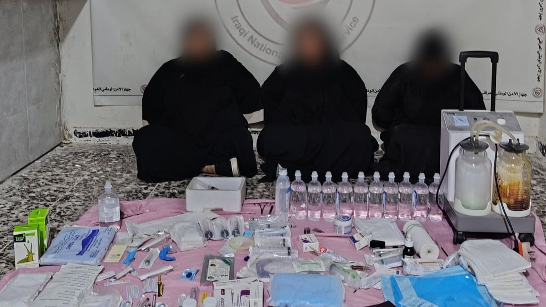 بصراوية استقدمت أجنبيتين وحولت منزلها لغرفة عمليات تجميل وشفط دهون