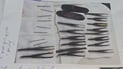 Doctors remove 26 sharp objects from man’s stomach in Sulaymaniyah