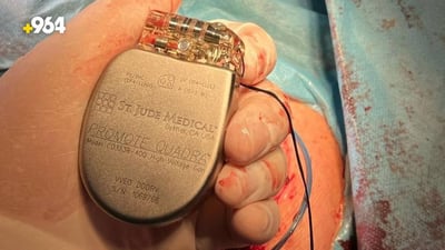 Duhok sees surge in pacemaker implants