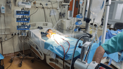 بە ئامێرێکی پێشکەتوو بۆ یەکەمجار نەشتەرگەرییەک ئەنجامدرا