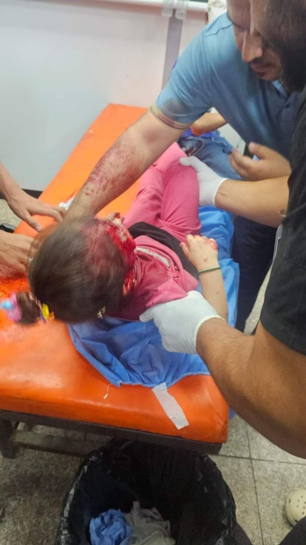 قطيع من الكلاب السائبة يهاجم 8 أطفال في الناصرية ويصيبهم بجروح متفاوتة