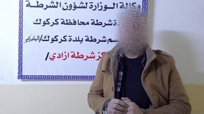 شرطة كركوك تعتقل متهماً أحرق طليقته بـ”التيزاب”