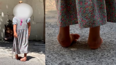 ساڵێكه‌ حاجیاوا به‌دواى چاره‌سه‌ركردنى كچێكى ته‌مه‌ن 9 ساڵانه‌