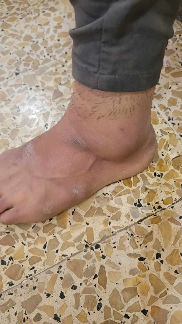 شوانکارەیەک چوار کرێکارى شارەوانى بریندار دەکات
