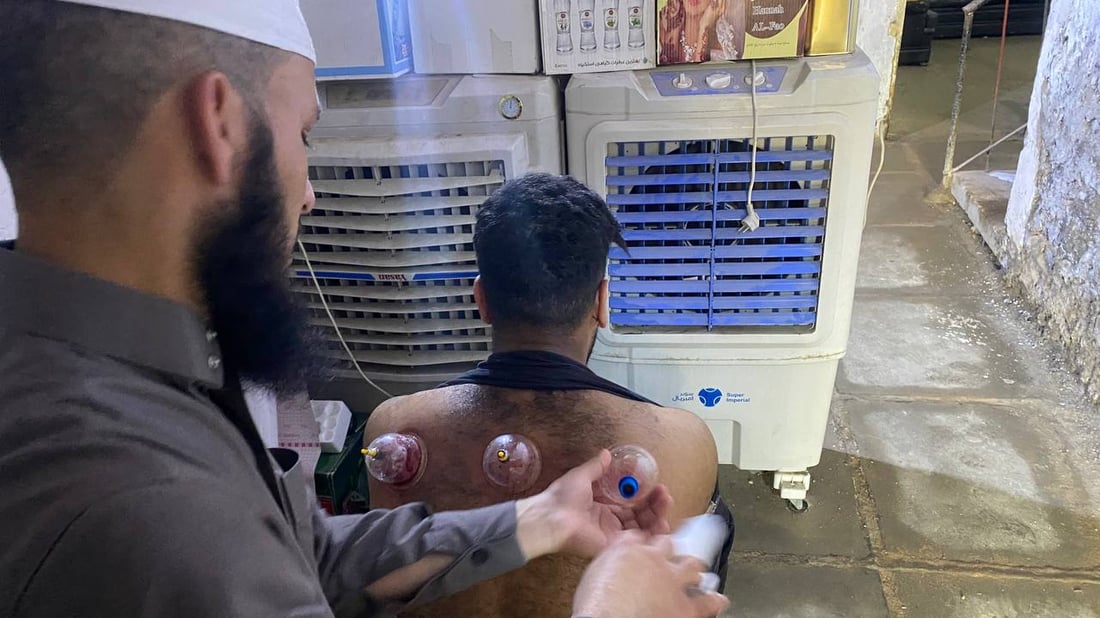 الحصوة تتجه إلى العشابين أكثر من الأطباء: لسنا مشعوذين بل نحاربهم (صور)