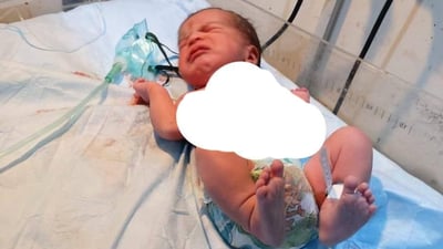 عادة ما يتم التضحية بالجنين.. فريق طبي في واسط ينجح عملية قيصرية طارئة