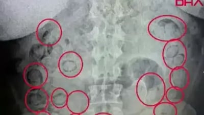 433 گرام ماددەی هۆشبەر لە ناو “گەدە”ی بوو