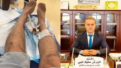 Deputy health director in Sulaymaniyah hurt in stray dog attack