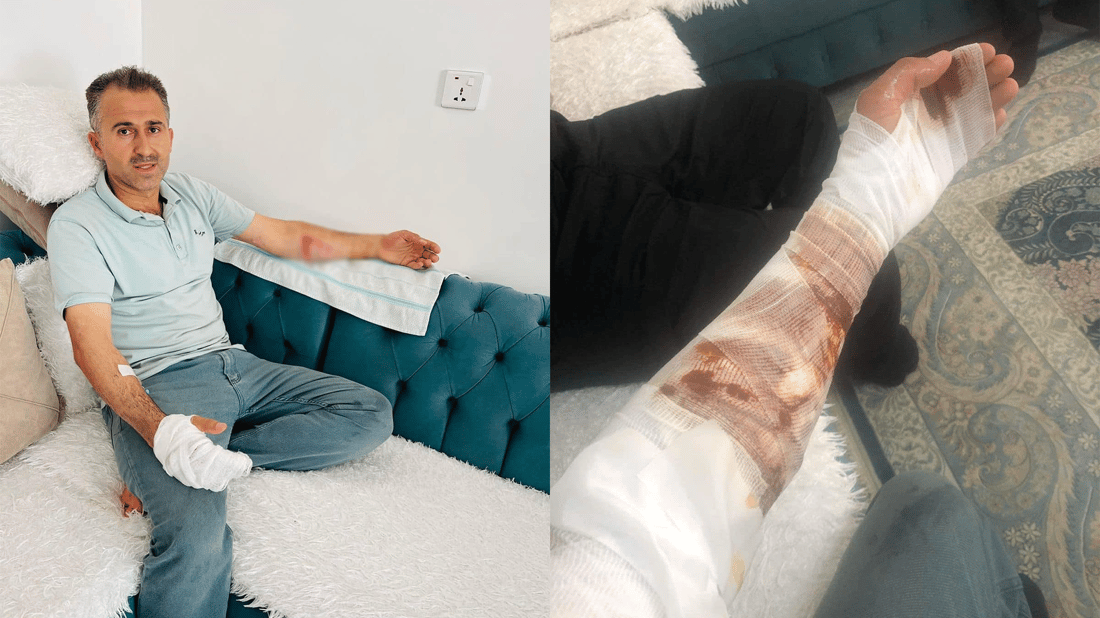 لە کاتی کوژاندنەوەی ئاگردا ئەفسەرێکی بەرگری شارستانی کێوەڕەش سووتا