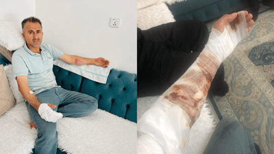 لە کاتی کوژاندنەوەی ئاگردا ئەفسەرێکی بەرگری شارستانی کێوەڕەش سووتا