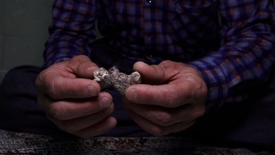 لە شوێنی گورچیلە دەرهێنراوەکەی بەرد پەیدا دەبێت