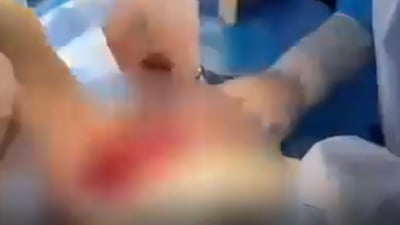 لە چەمچەماڵ شوشەى گوڵدانێک ریخۆڵەى منداڵێکى خستە دەرەوە