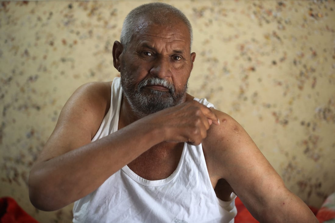 Saad Abbas, 59-years-old, who was injured by a random gunshot in his home in a village in the Yusufiya area near Baghdad  on May 20, 2024, shows off his injury (Photo by AHMAD AL-RUBAYE / AFP)