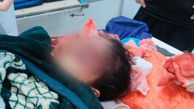 شط العرب: “قرية البتران” تُفجع بلغم جديد مزق جسد الطفلة زينب وتبرعات لعلاجها