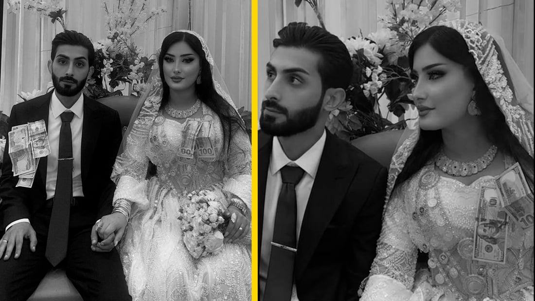 عريس يسقط خلال حفل زفافه ويدخل بغيبوبة شهرين قبل أن يفارق الحياة في دهوك