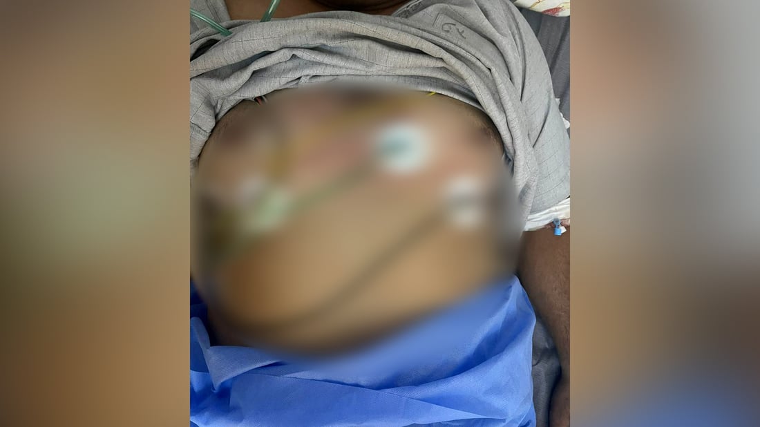مات.. ثم عاد قلبه يخفق بعد 24 صعقة في مستشفى كركوك