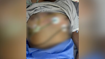 مات.. ثم عاد قلبه يخفق بعد 24 صعقة في مستشفى كركوك
