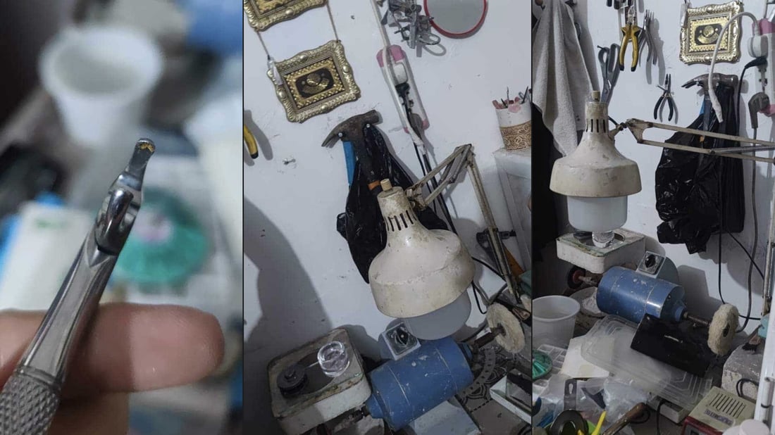 صور: كان يزرع أسناناً لرجل من زاخو فاعتقلته الشرطة.. عيادة في المنزل “بلا شهادة”