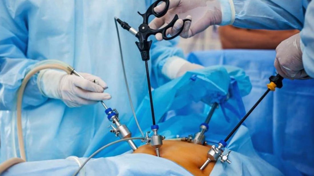 نەشتەرگەری بچوکردنەوەی گەدەی کرد و گیانی لەدەست دا