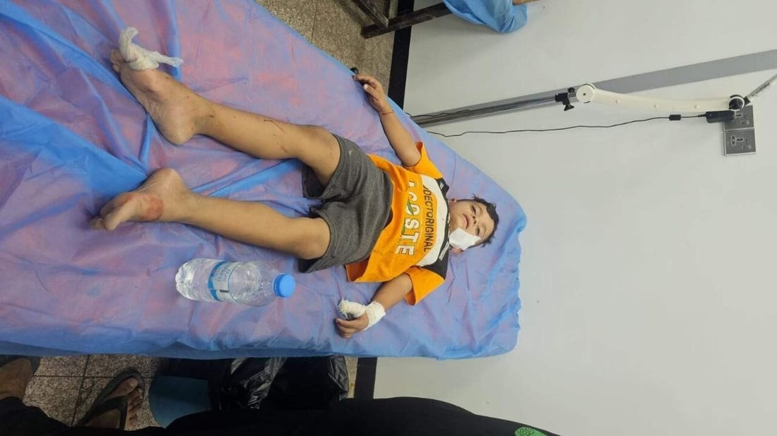 قطيع من الكلاب السائبة يهاجم 8 أطفال في الناصرية ويصيبهم بجروح متفاوتة