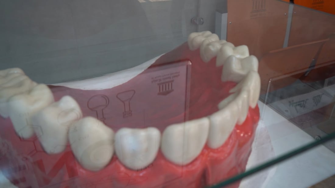 جامعة المعقل تصنع “أكبر فك أسنان” في العالم.. لتدريب الطلبة ودخول “غينيس”