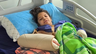 سێ رۆژ بەر لەئێستا دەستێکی شکابوو و کەچی دوێنێش دەستەکەی تری شکا
