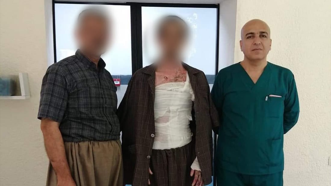 گەنجێک لە سلێمانی دوای سوتانی جەستەی بە ڕێژەی 64% نەخۆشخانەی جێهێشت