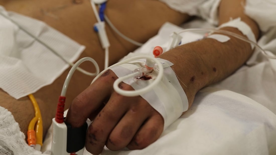 پسپۆڕێک: ئەو پەتا وەرزییەی هەیە ئەنفلۆنزا یان کۆرۆنایە