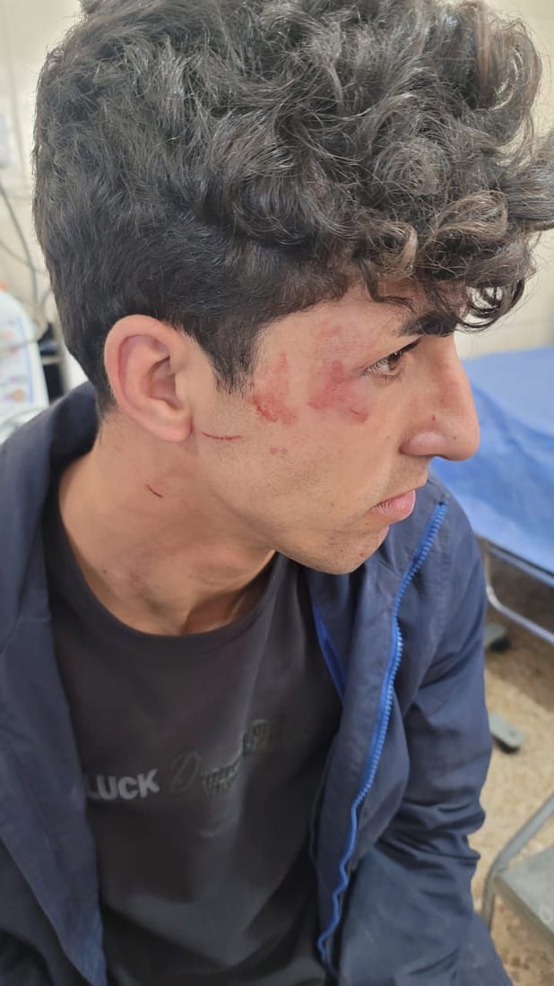 “نقلوا للمستشفى”.. رعاة يعتدون على عمال بلدية آلتون كوبري أثناء تفريغ النفايات