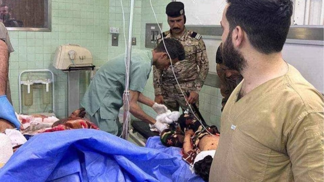 لغم يبتر يد زينب ويصيب عين حسين.. غضب في بدرة بعد حادثة الطفلين