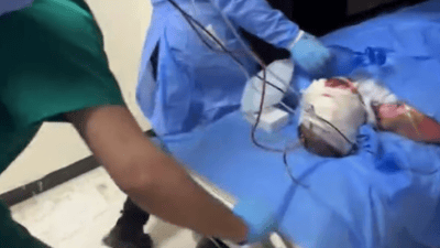 تەقینەوەی سپلێتێکی ماڵان کەسێکی بە تەواویی سووتاند