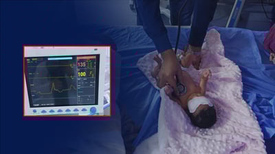 له‌ به‌سڕه‌ چاره‌سه‌رى منداڵێك كرا حاڵەتێکی دەگمەنی تەندروستی هەبوو