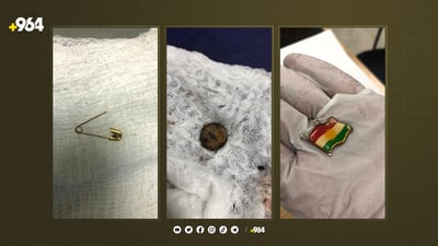 35 منداڵ بەهۆی قوتدانی پارچە ئاسنی بچوکەوە براونەتە نەخۆشخانە