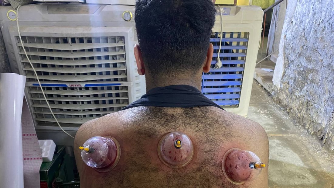 الحصوة تتجه إلى العشابين أكثر من الأطباء: لسنا مشعوذين بل نحاربهم (صور)