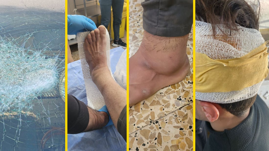 “نقلوا للمستشفى”.. رعاة يعتدون على عمال بلدية آلتون كوبري أثناء تفريغ النفايات